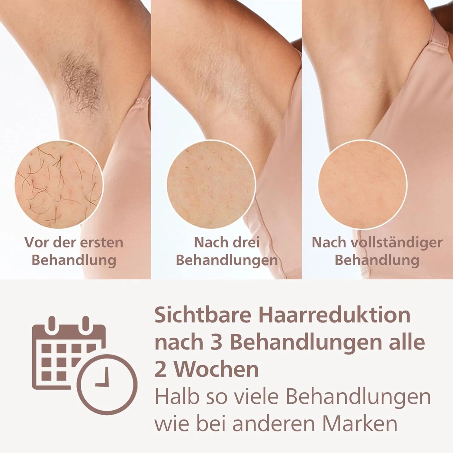 Philips Lumea IPL Haarentfernungsgerät 9000 Series – Haarentfernungsgerät mit SenseIQ Technologie, 3 Aufsätze für Körper, Gesicht und Präzision, kabellos (Modell BRI955/00)